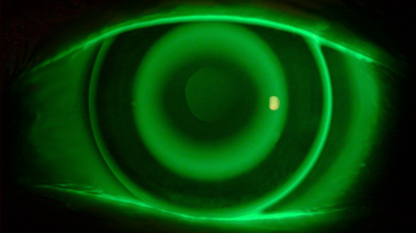 Servicios Ópticos > Control de miopía 4 lentes nocturnas