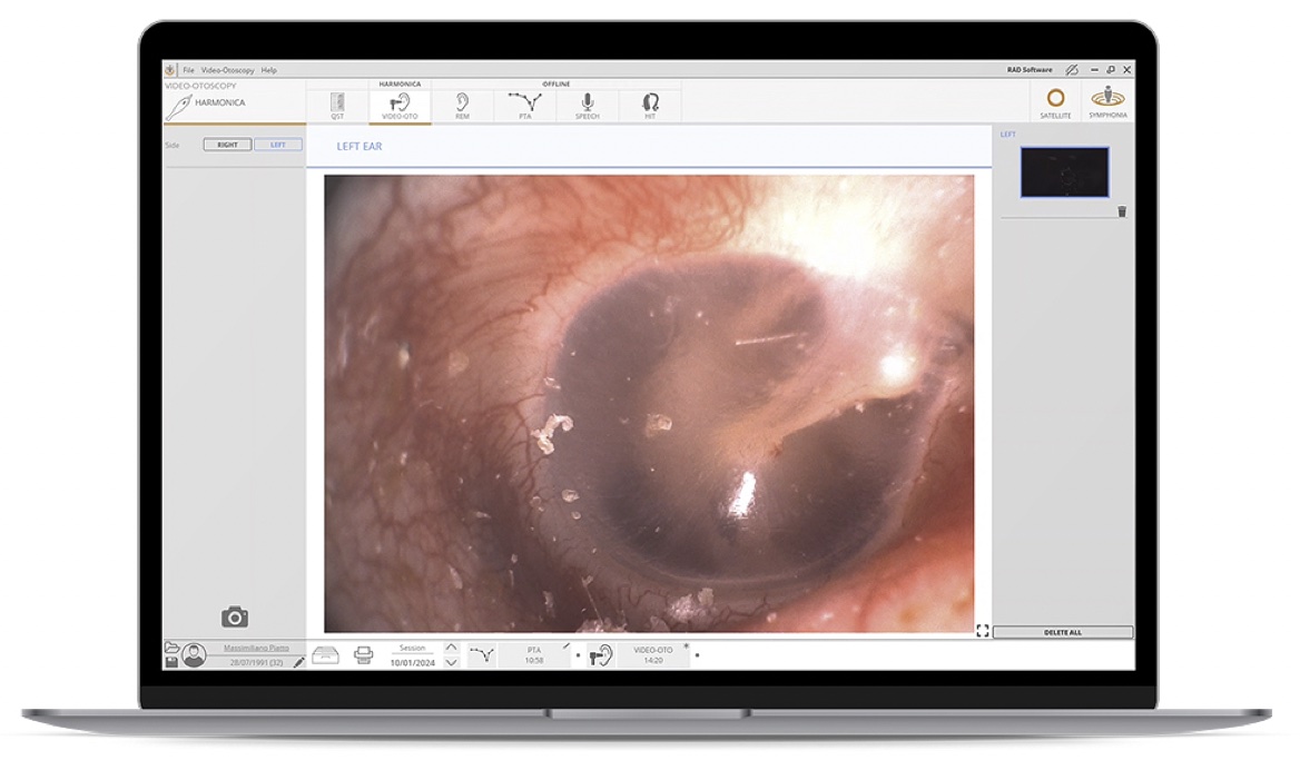 Servicios auditivos 2 Videotoscopia